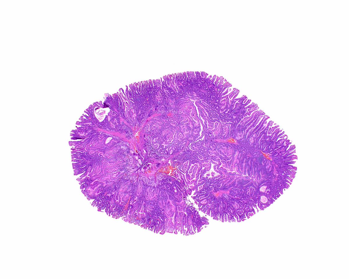 UMiami Pathology tweet media