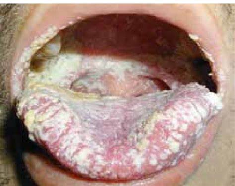 Franklin「𝑹」Sheckler 💡 tweet media