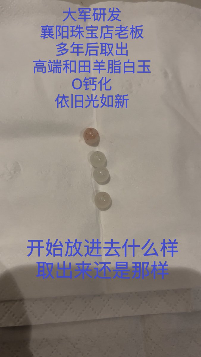 dajun123123's tweet photo. 大军入一珠用的材料比较好，不钙化，一对比就出来了。 https://t.co/keuVz7Xmka