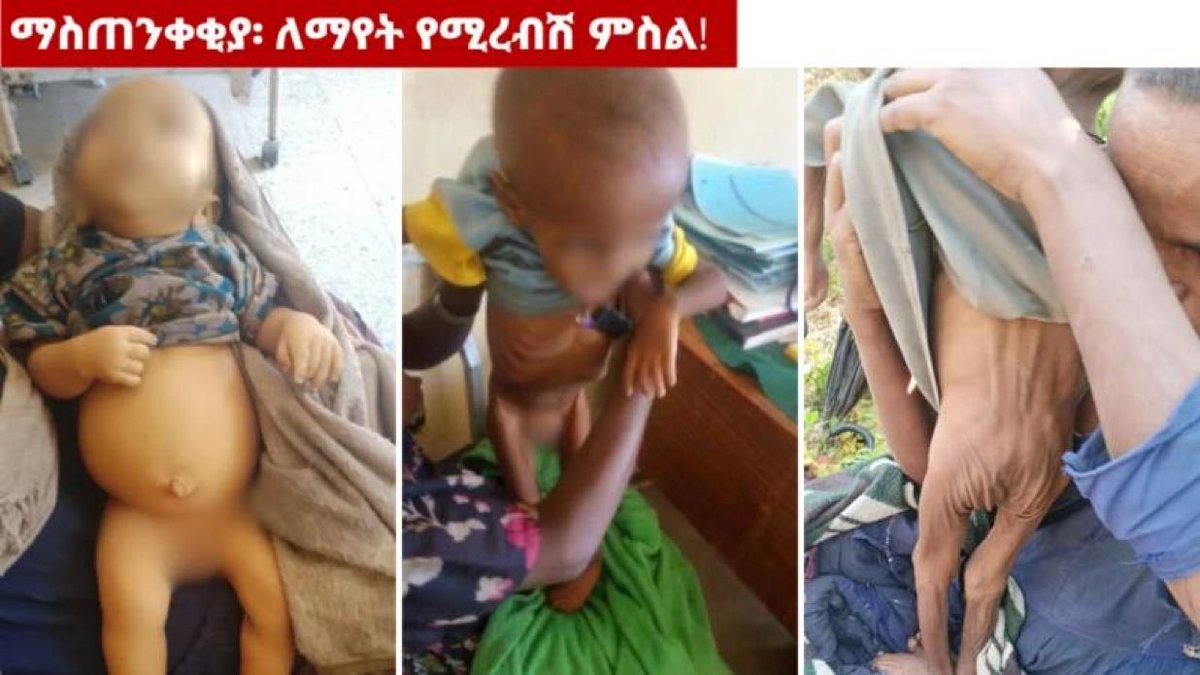AmharaHQ's tweet photo. Urgent emergency food assistance ‼️ Ethiopian tyrannical gov, a member of @UN_HRC is blocking food &amp; medicine reaching Amhara region, North wollo, Bugena district leading to kids starving to death &amp; over 10k facing similar fait @USAIDSavesLives @WFP_Ethiopia @WFPChief @theweeknd https://t.co/HM3q6ncpvr