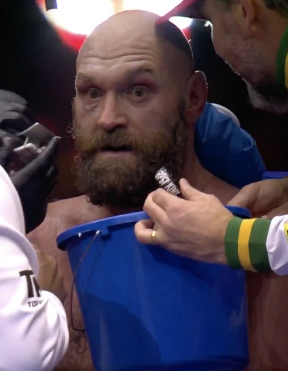 BleacherReport's tweet photo. TYSON FURY'S ONLY TWO LOSSES OF HIS CAREER HAVE BEEN TO USYK 🤯

#Usyk2Fury https://t.co/GUMlOVmAMO