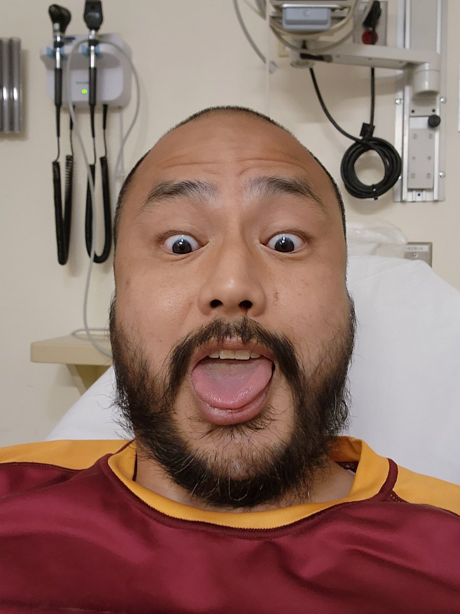 JohnATNguyen's tweet photo. VIEWER DISCRETION ADVISED!!! And I'm not just talking about my questionably handsome face lol

A random Saturday nearly exactly a year ago today, I suffered a little scratch that took me out for the rest of the 2024 #Rugby season... OK truthfully I blew out my #Achilles for the second time as it never rehabbed properly the first time - we still won that four-quartered preseason game and finished the 2024 season with a 6-4 record in 3rd place at @SoCalRugbyUnion D2 semi-finals (only to lose to the division's eventual national champions actually)!!!

Thank you to all who have supported my #leadership journey, especially now that I'm in @QuanticSchool's @ValarInstitute program!!!

It was an honor to have served as an officer with @SFV_Rugby... and any #medical colleagues want to guess the technique that was used to stitch me back together?! 🫡

#Fortitude #resilience #tenacity