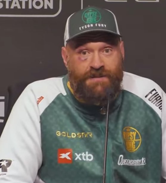 Tyson Fury'nin AI'nın maçı 118-112 Oleksandr Usyk'e kazandırması üzerine tepkisi:

"Bütün bilgisayarları siktir et. İnsanları çalıştırmaya devam et. İnsanlar için daha fazla iş, bilgisayarlar için daha az iş. Elektrikli arabalarıda s*keyim."