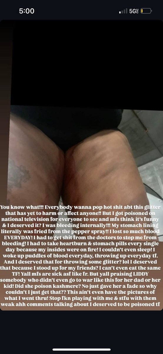 AshMelanin's tweet photo. The screenshots: https://t.co/nQgeMsA9ib