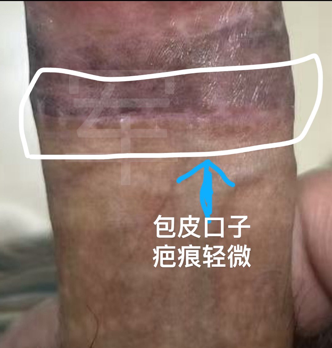 dajun123123's tweet photo. 达州高分作品，大军都隐形的极简风格～入一珠➕割一包一皮，简直太好看，对象绝对想舔一口。 https://t.co/uUFPB7peFj