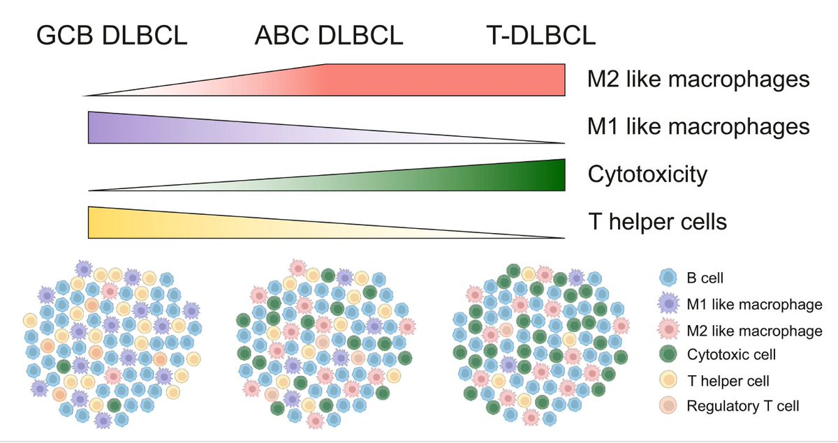 LeppaSM's tweet photo. For example, ABC DLBCL has a more cytotoxic TME, and a predominance of M2-like TAMs, whereas T helper cells and Tregs characterize the TME in the GCB DLBCL. The TME in T-DLBCL is similar to the TME of ABC DLBCL.
M Autio, @LeivonenSuvi @oscarbruck @MarjukkaPollari  et al. https://t.co/wL3jnKT1TF