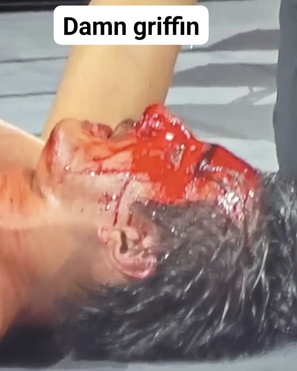 Necroeric's tweet photo. I've never seen @TheGriffinMcCoy bleed like he did tonight. WOW.
#CZW #CODXXII https://t.co/9ptrMcOvCC