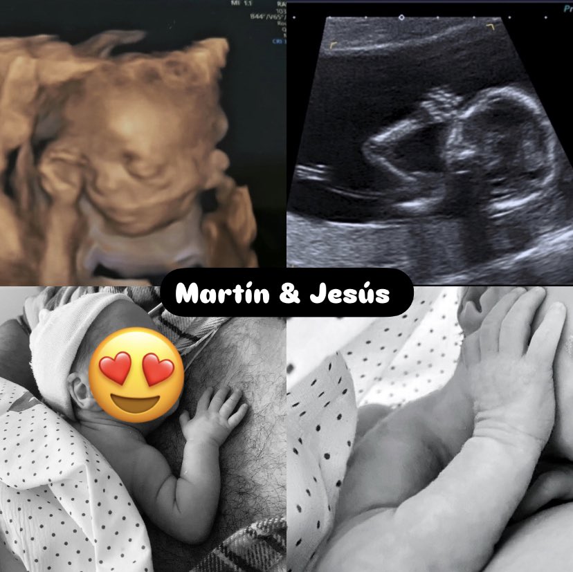 isahuelva5's tweet photo. El día de la lotería ha sido y será siempre uno de mis días favoritos. 
Solo pido que le toque a quien más lo necesite, a nosotros ya nos tocó el gordo este año con nuestros niños ❤️ 

Salud para verlos crecer 🍀 #LoteriaRTVE #loteriadenavidad #LoteriaNavidad2024 https://t.co/25DqFuzYN5