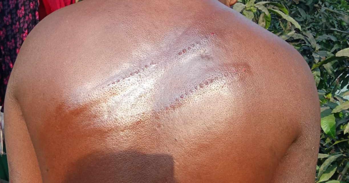 টাঙ্গাইলে মাদক বিক্রিতে বাধা দেয়ায় এক ব্যক্তিকে গাছে বেধে পিটিয়ে আহত