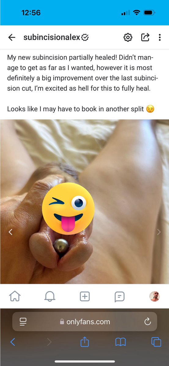 Follow me to see my latest subincision split progress! It is looking soo HOTTTT OMG 

onlyfans.com/subincisionkiwi

#OF #subincision #subincisionalex #porn #urethral #sounding #pierced #cutting #bodymod #Trending #r18 #nude #bigcock #circumcised