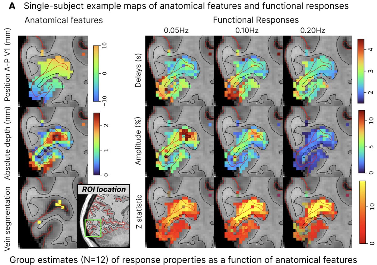 New paper in Imaging Neuroscience by Daniel E.P. Gomez, Jonathan R. Polimeni, and Laura D. Lewis:

The temporal specificity of BOLD fMRI is systematically related to anatomical and vascular features of the human brain

doi.org/10.1162/imag_a…