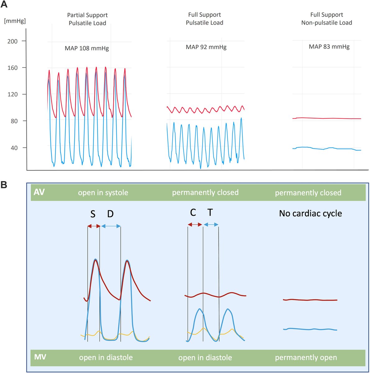 JACC Journals (@jaccjournals) on Twitter photo 🚨🚑 🆕 in #JACCINT: 🚀 First-in-human study of the #MagentaElevate pump shows safety & hemodynamic support for high-risk LM interventions! 💓🩺 14 pts, 0 device-related adverse events. Game-changer for HR-PCI! 🏥💉 jacc.org/doi/10.1016/j.…
#PCI #MCS 🚨🚑 🆕 in #JACCINT: 🚀 First-in-human study of the #MagentaElevate pump shows safety & hemodynamic support for high-risk LM interventions! 💓🩺 14 pts, 0 device-related adverse events. Game-changer for HR-PCI! 🏥💉 jacc.org/doi/10.1016/j.…
#PCI #MCS