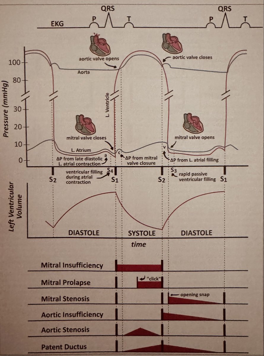 Cardiac cycle