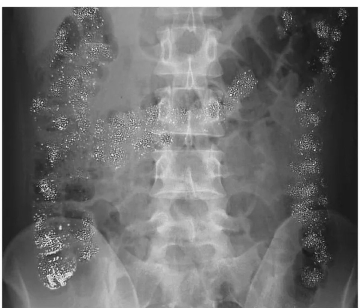 Oren Gottfried, MD tweet media