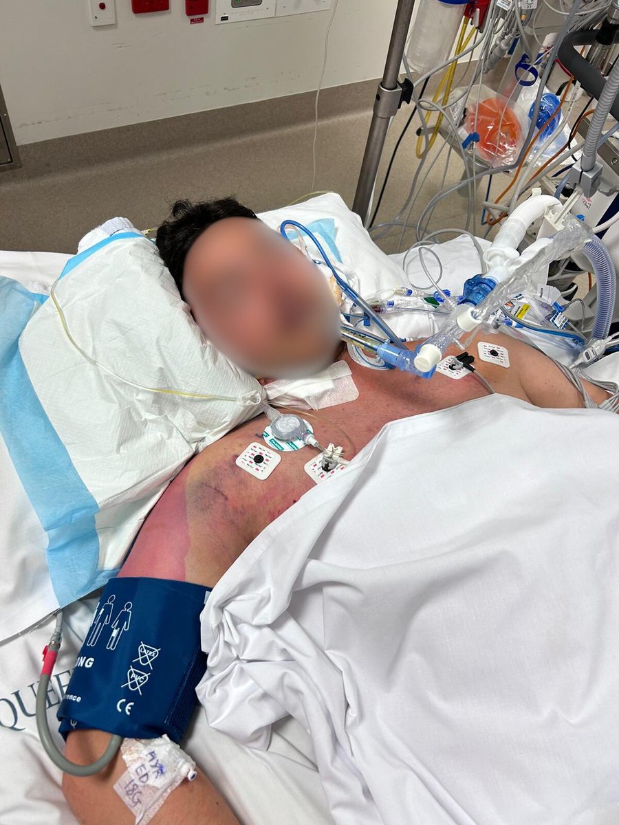 These photos were taken roughly 24hrs apart 6 months ago. Never expected to be fighting for my life during a holiday, which before all this was was filled with so many memories! A reminder to enjoy the moment as it can all change so quickly.