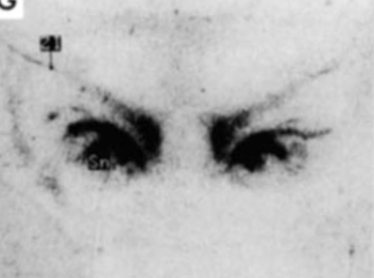 This is in a publication from my lab. Any guesses what this photo is?