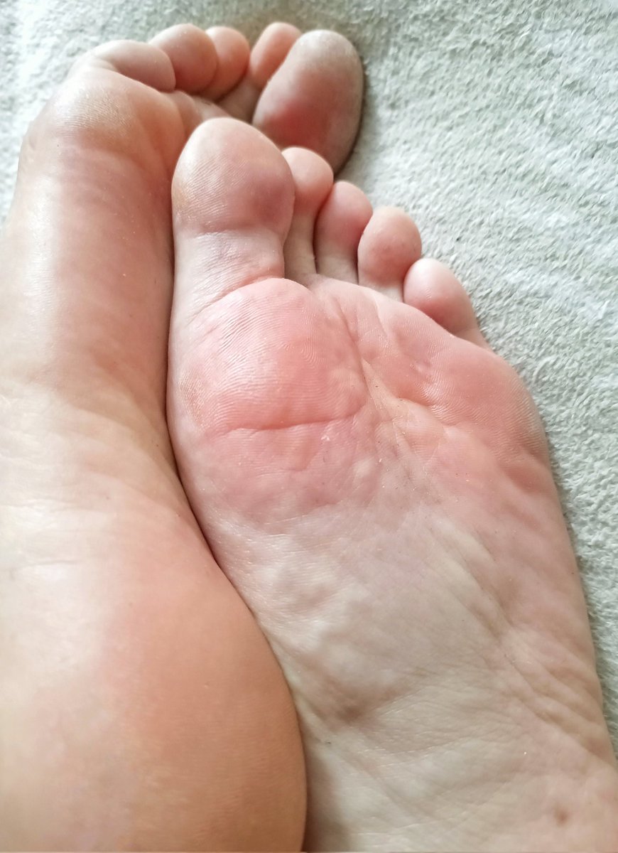 absoleutist's tweet photo. Post-hike bliss ✨👣✨
#gayfeet #FootLovers #FootModel #footworshi̇p #barefoot #footfetish #soles #hairylegs https://t.co/w0U9XEf3sO