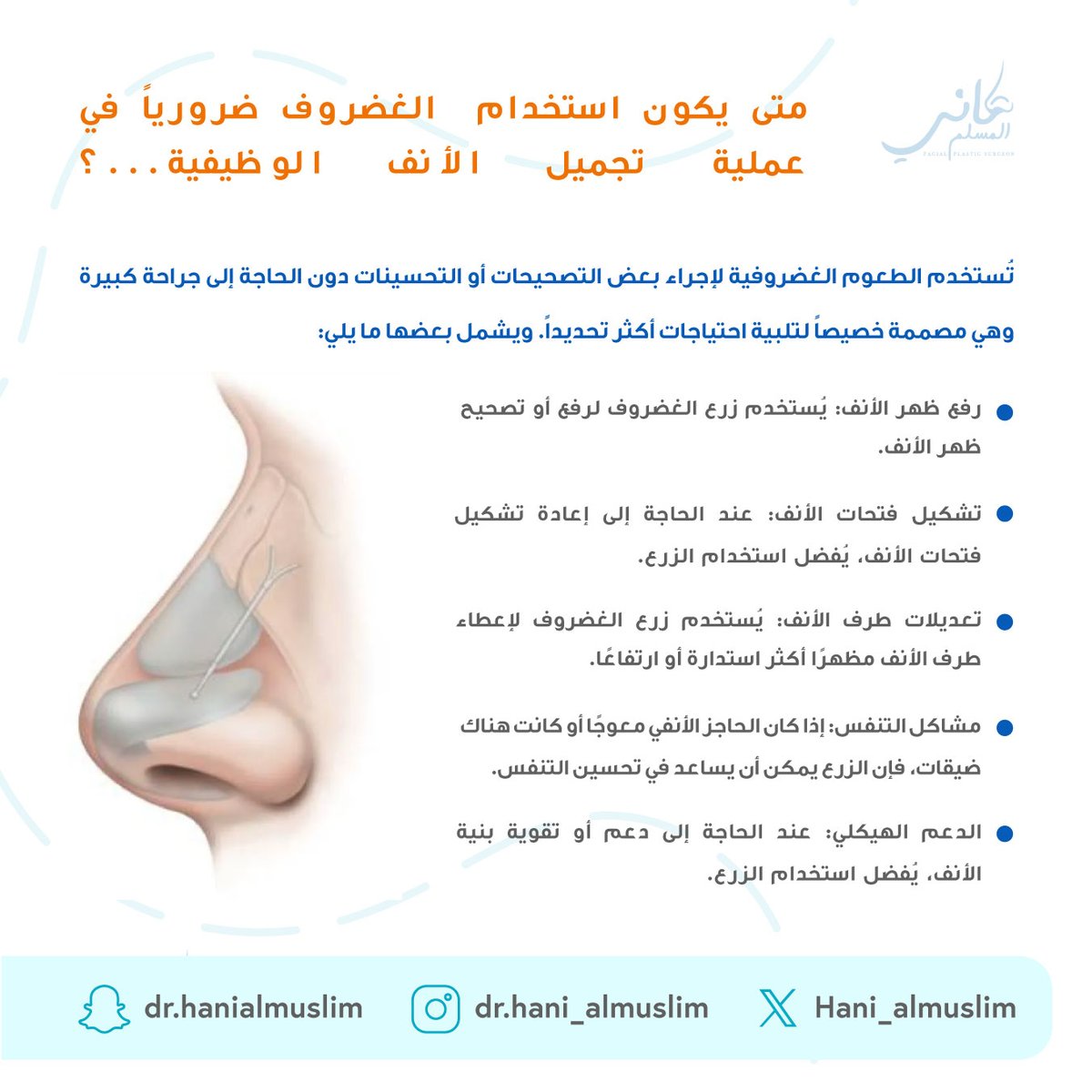 متى يكون استخدام الغضروف ضروريا في عملية تجميل الأنف الوظيفية...؟ 🤔👃🧑‍⚕️

#استشاري #عيادة #دكتور_تجميل #استشاري_تجميل #عملية_تجميل_الأنف #نصيحة #تجميل #تجميل_الانف #هاني_المسلم #جراحة #جراحة_تجميلية #عمليات_تجميل #تجميل_أنف #تجميل_الوجه #ترميم_الوجه #الطب_التجميلي #جراحة_تجميلية