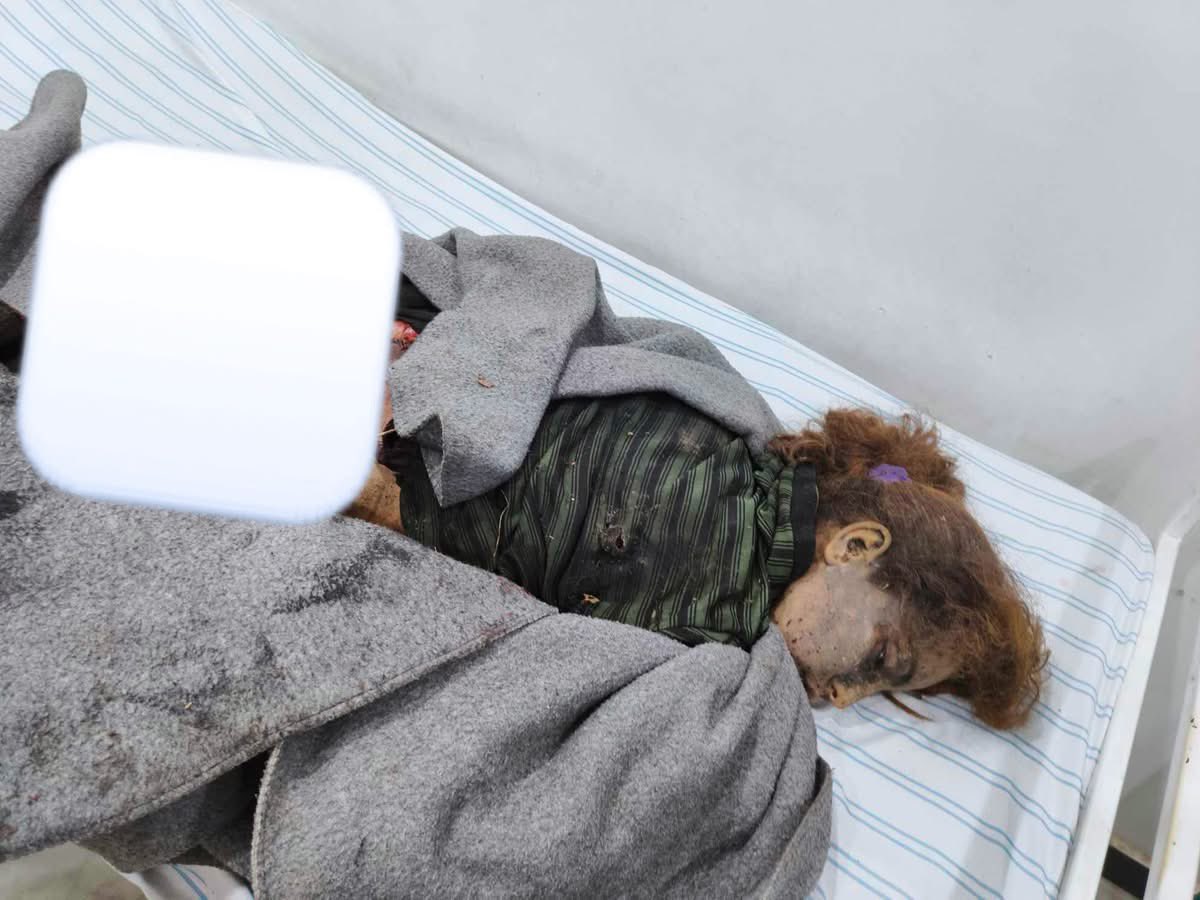 statelessidea's tweet image. Turkish shelling kills  12-year-old child and her mother  - in Cade village, south of Kobane
#Kobane
#StandWithRojava