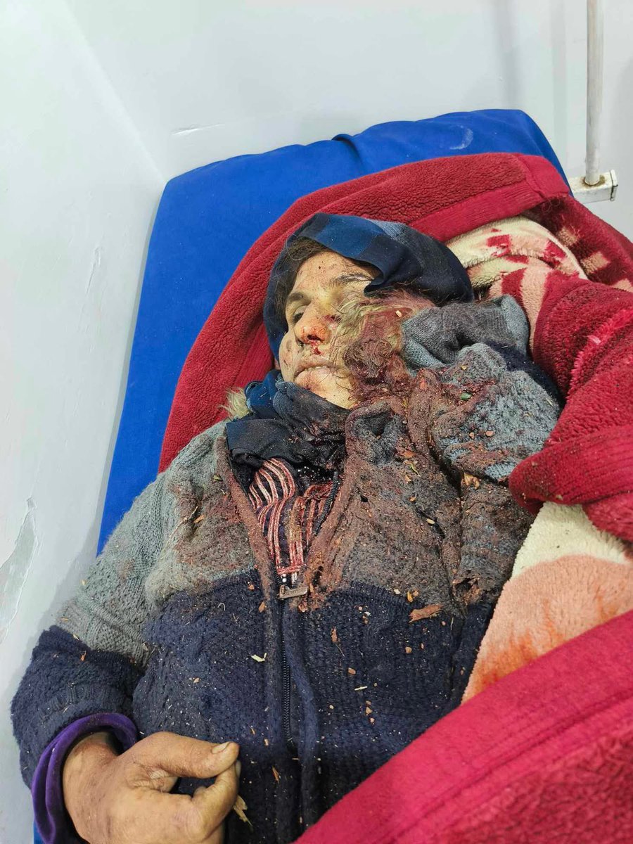 statelessidea's tweet image. Turkish shelling kills  12-year-old child and her mother  - in Cade village, south of Kobane
#Kobane
#StandWithRojava