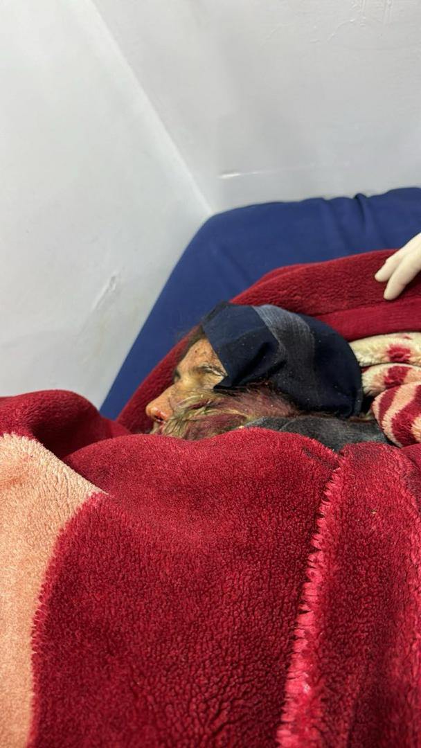 ameddicleT's tweet photo. Turkey and the paramilitary groups it supports bombed the village of Cad, south of Kobanê, with heavy weapons, killing a 12-year-old child and their mother. https://t.co/NPplrUzaxi