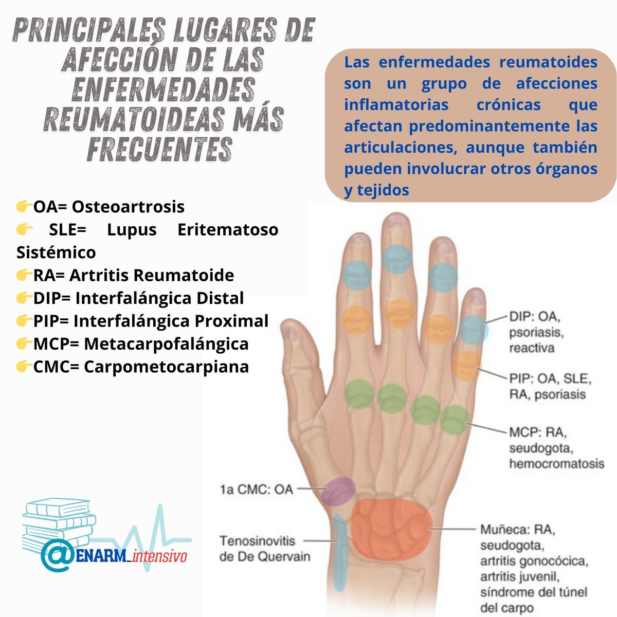 ENARM_intensivo's tweet photo. 💢Principales lugares de afección de las enfermedades reumatoideas más frecuentes

#ENARM_INTENSIVO #ENARM2025 #ENARM https://t.co/Hdkt5M9s5G