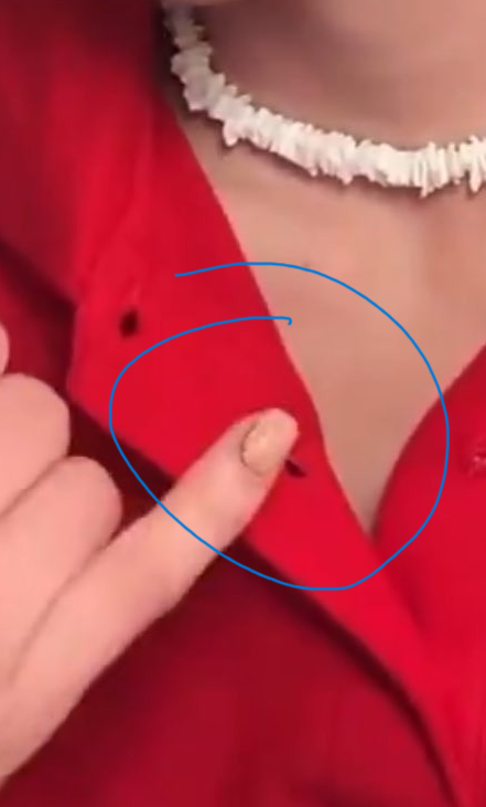 BeauxPortier's tweet photo. @MattWallace888 What's this brown shit around his nail? https://t.co/kIs9FIiB7r