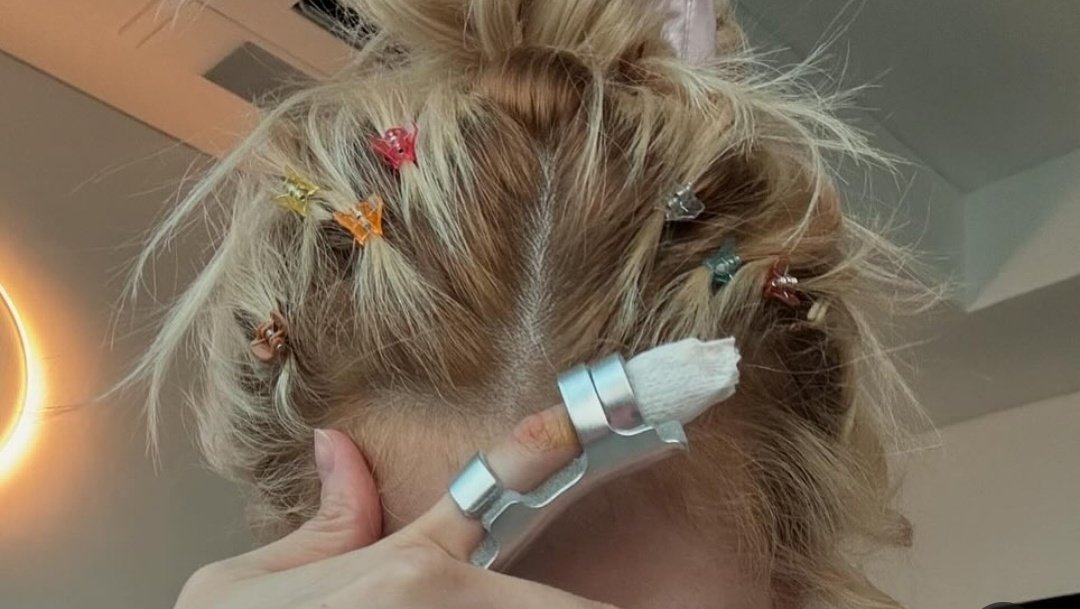 Doeu mais pra colocar no lugar do que quando eu tirei.