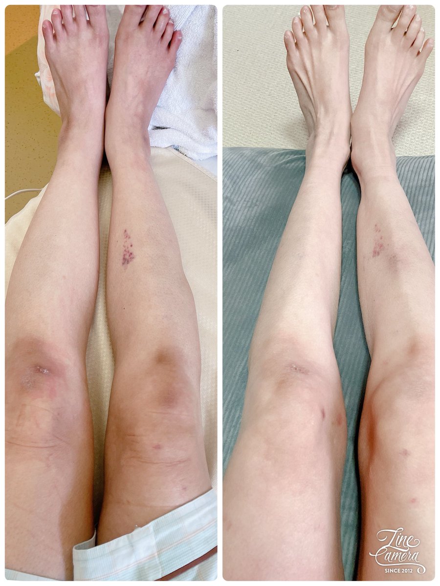 まめちゃん (@AyakoS500407) / Posts / X