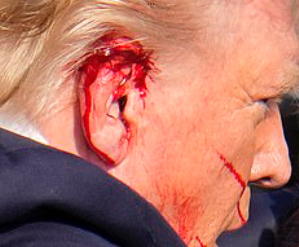 ItsAllATheatre's tweet photo. #PoliticalTheatre Miraculous healing or #stagedpsyop. #TheWorldsaStage filled with deceptive theatrical performances. ‘DOCTORed’ ‘OPERAtions’ in ‘THEATRE’=#Staged. No blood on shirt or hand when wiping ear. ‘Moneymaker’ photographer. https://t.co/judPeupez7