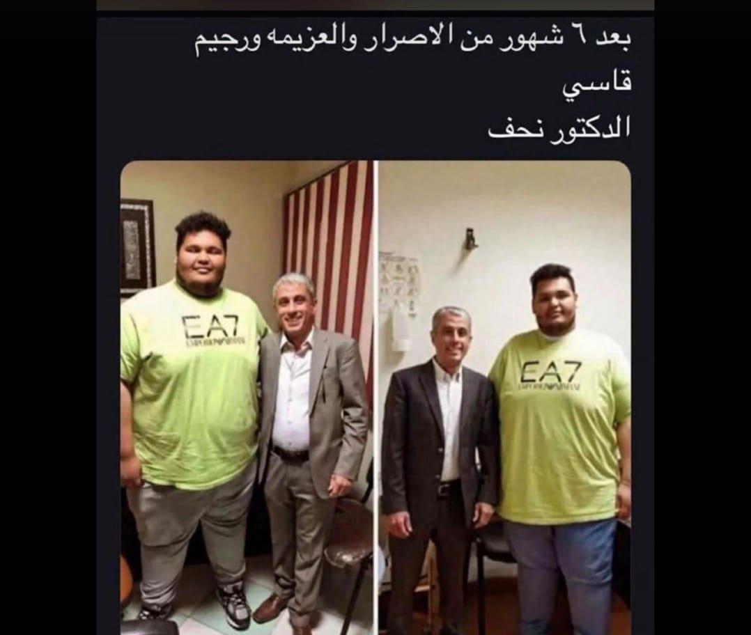 بعد ٦شهور من إلاصرار والعزيمة ورحيم قاسي 
الدكتور نحف🤣🤣🤣🤣🤣🤣🤣