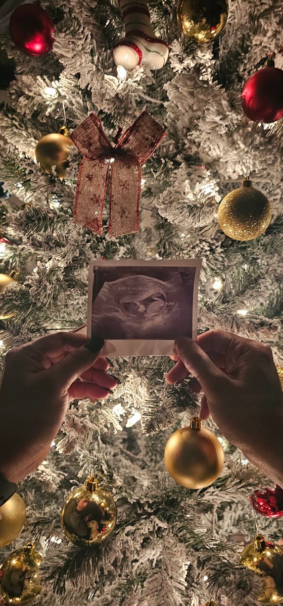 CryptoAudiKing tweet media