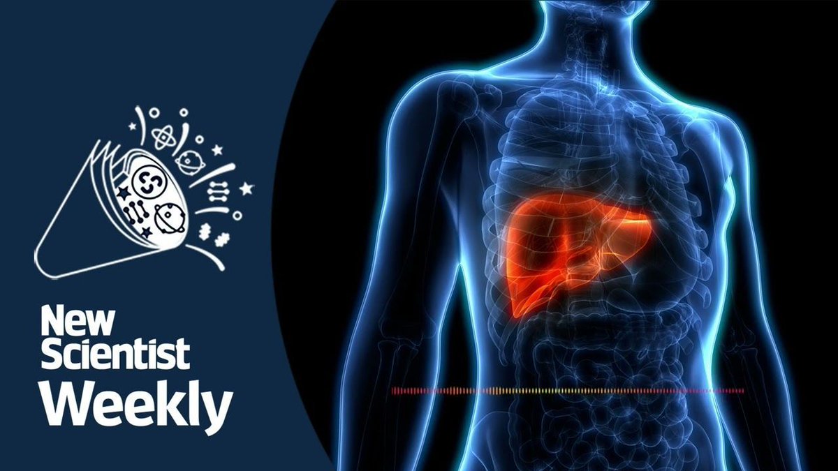 Miniature livers made from lymph nodes begin human trials | New Scientist Weekly podcast 244: buff.ly/49yfwtW