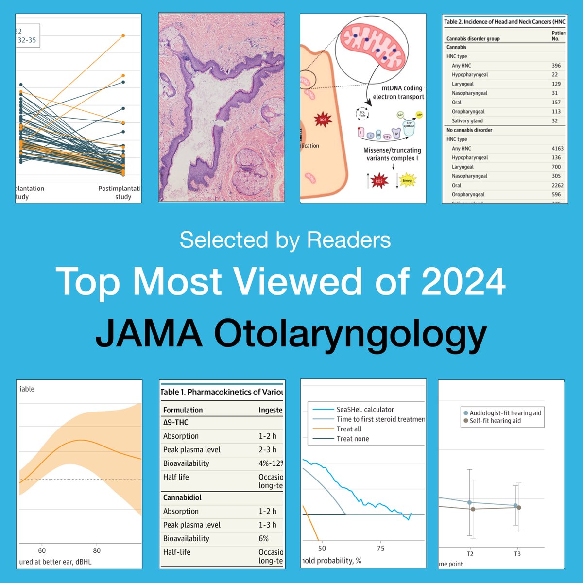 JAMAOto's tweet photo. Read the most popular JAMA Otolaryngology articles published in 2024.

https://t.co/0fFmmOWu3W https://t.co/nkvne8yxo1
