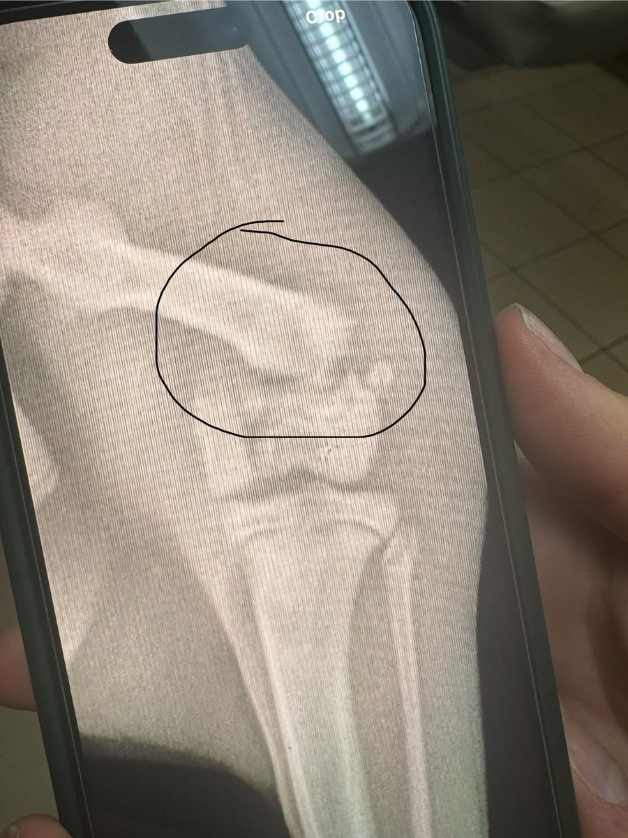 hbabe05's tweet photo. @pulte please pick me!!! 🙏🏻🤞🏻 so I can try and reach my goal to get my kitty’s leg amputated. He has a fractured femur.  Heather Walker-  $hbabe05 https://t.co/tZ1IWt9DiA
