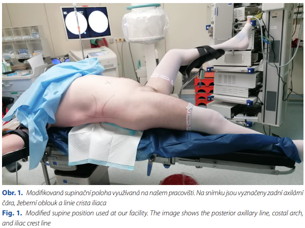 Czech urology (@czechurology) on Twitter photo Poslední letošní číslo 4-2024 je na světě. czechurol.cz/magno/cur/2024… Mj. jak řešit chylózní ascites po LAE, PEK (PCNL) na zádech, perzistující urachus, budoucnost robotiky, markery C61 v moči, o konferenci #CUS24 v Brně, nejlepší publikace 2023 #uroczech <a href="/CUS_CLS_JEP/">ČUS #uroczech</a> Poslední letošní číslo 4-2024 je na světě. czechurol.cz/magno/cur/2024… Mj. jak řešit chylózní ascites po LAE, PEK (PCNL) na zádech, perzistující urachus, budoucnost robotiky, markery C61 v moči, o konferenci #CUS24 v Brně, nejlepší publikace 2023 #uroczech <a href="/CUS_CLS_JEP/">ČUS #uroczech</a>