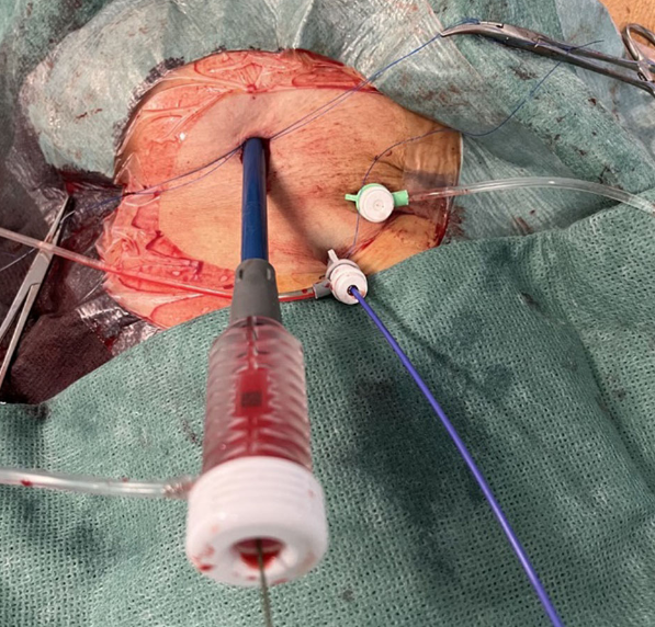 Giuseppe Biondi-Zoccai tweet media