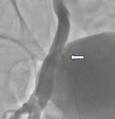 Giuseppe Biondi-Zoccai tweet media