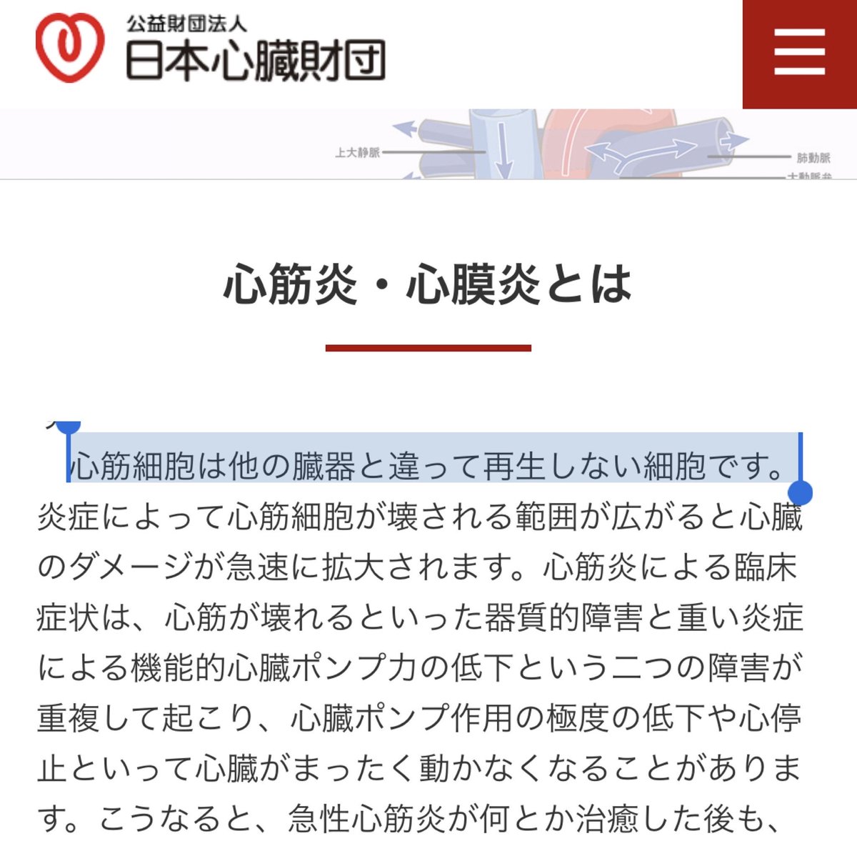 fumuniki's tweet photo. 再生しないので軽いもクソもない。壊れた範囲は壊れっぱなし。 https://t.co/SKkluukwES