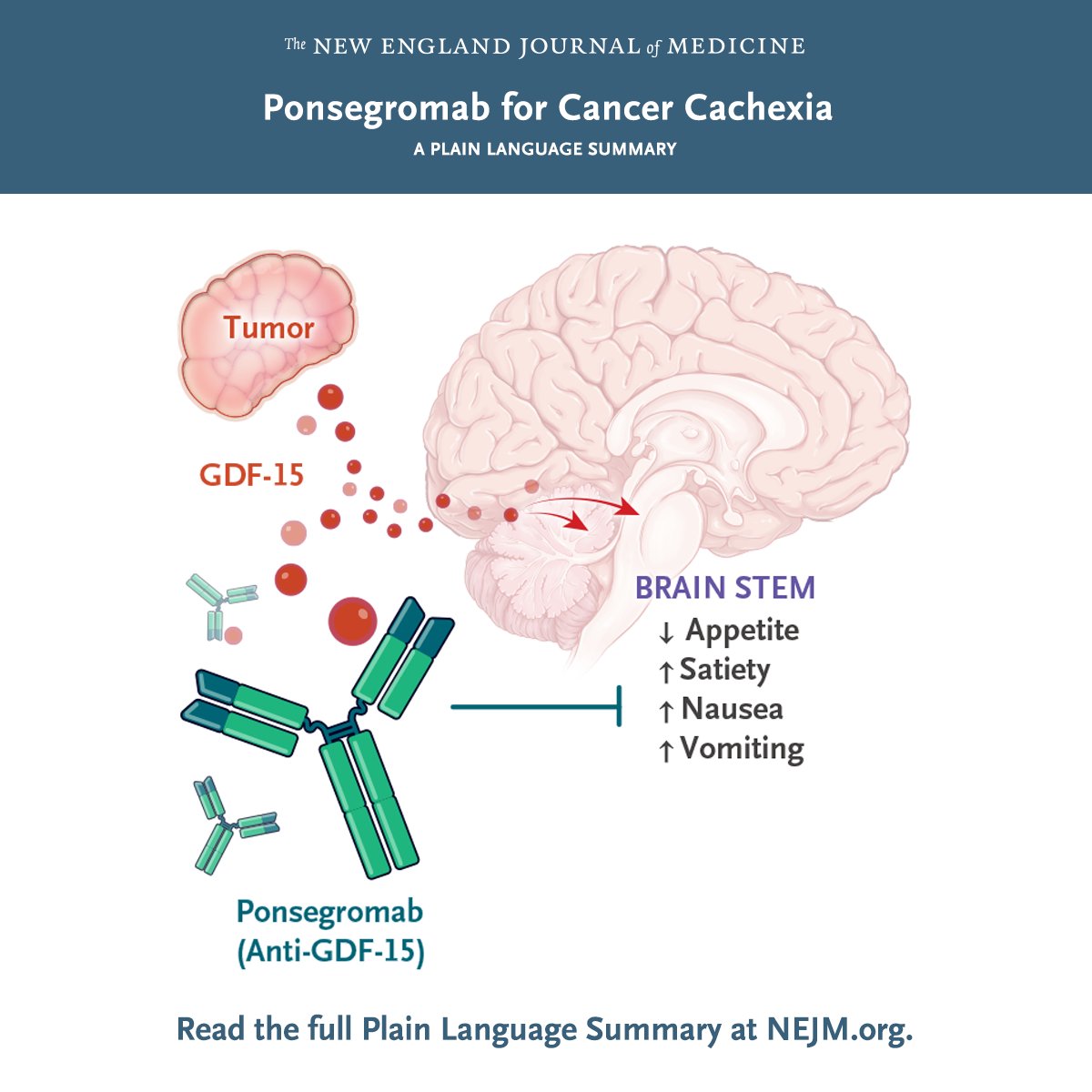In a phase 2 trial, researchers examined the safety and efficacy of the monoclonal antibody ponsegromab for treating cancer cachexia. Full trial results and Plain Language Summary: nej.md/3XE645a