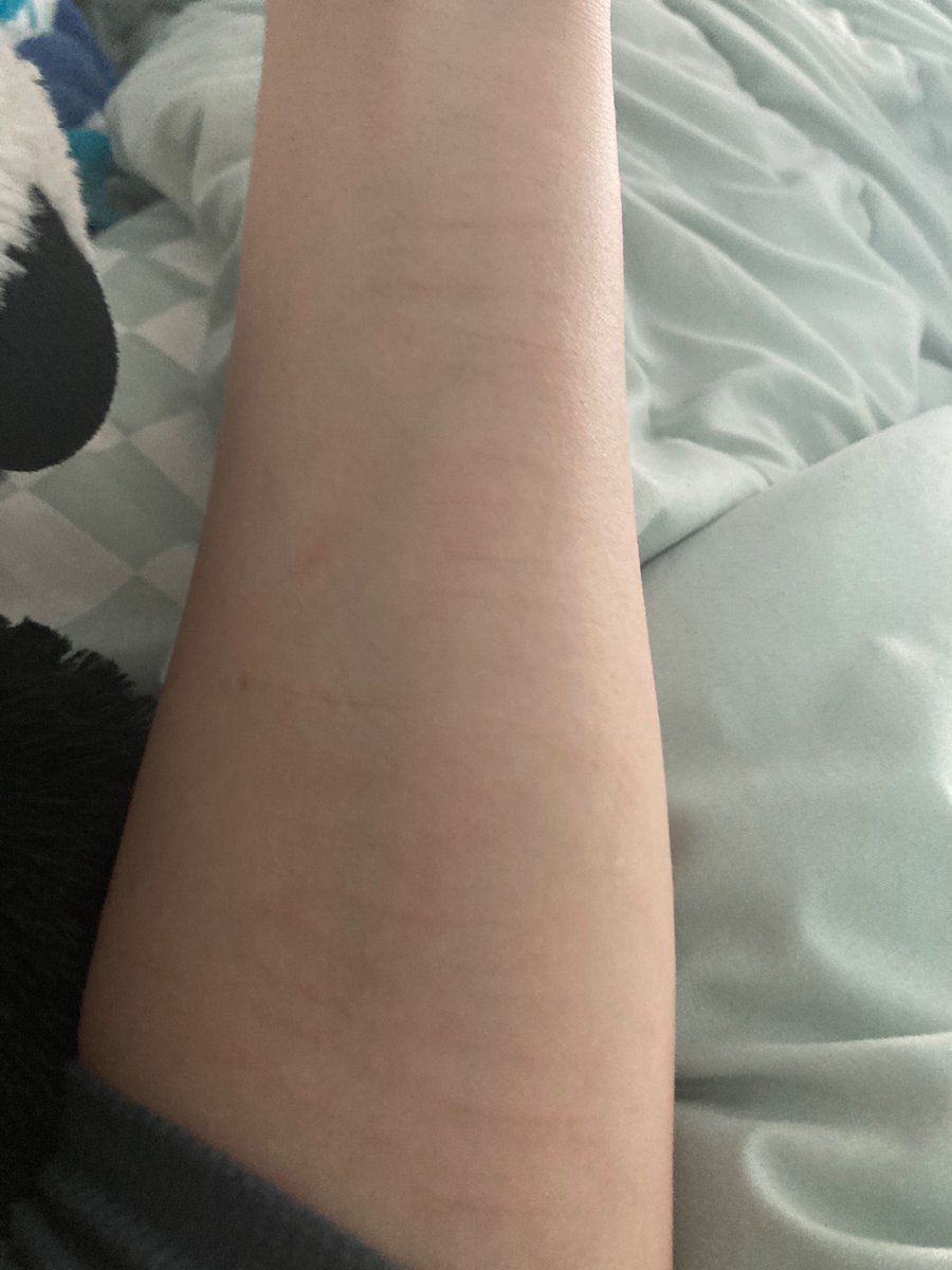 _AngelWynter_'s tweet photo. Permant scars… https://t.co/vUABk0L0y7