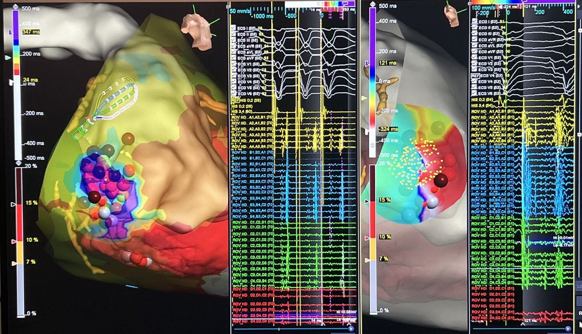 Ivo Roca, FEHRA, FESC tweet media