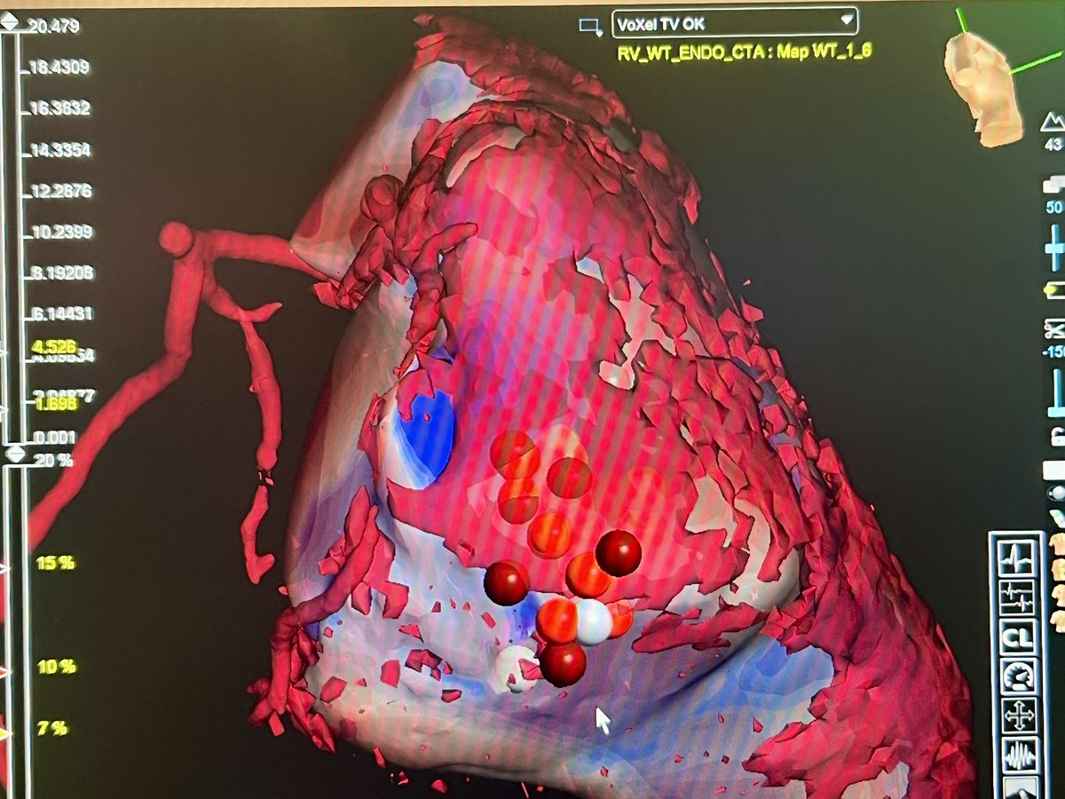 Ivo Roca, FEHRA, FESC tweet media