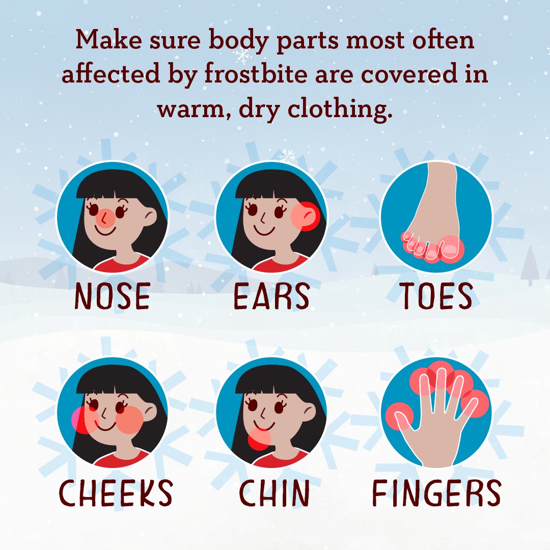 #Hypothermia and #frostbite can happen when prolonged exposure to cold causes the body to lose heat faster than it can produce it. Protect yourself when temperatures drop by taking steps to prevent hypothermia and frostbite: bit.ly/41JEdmV
