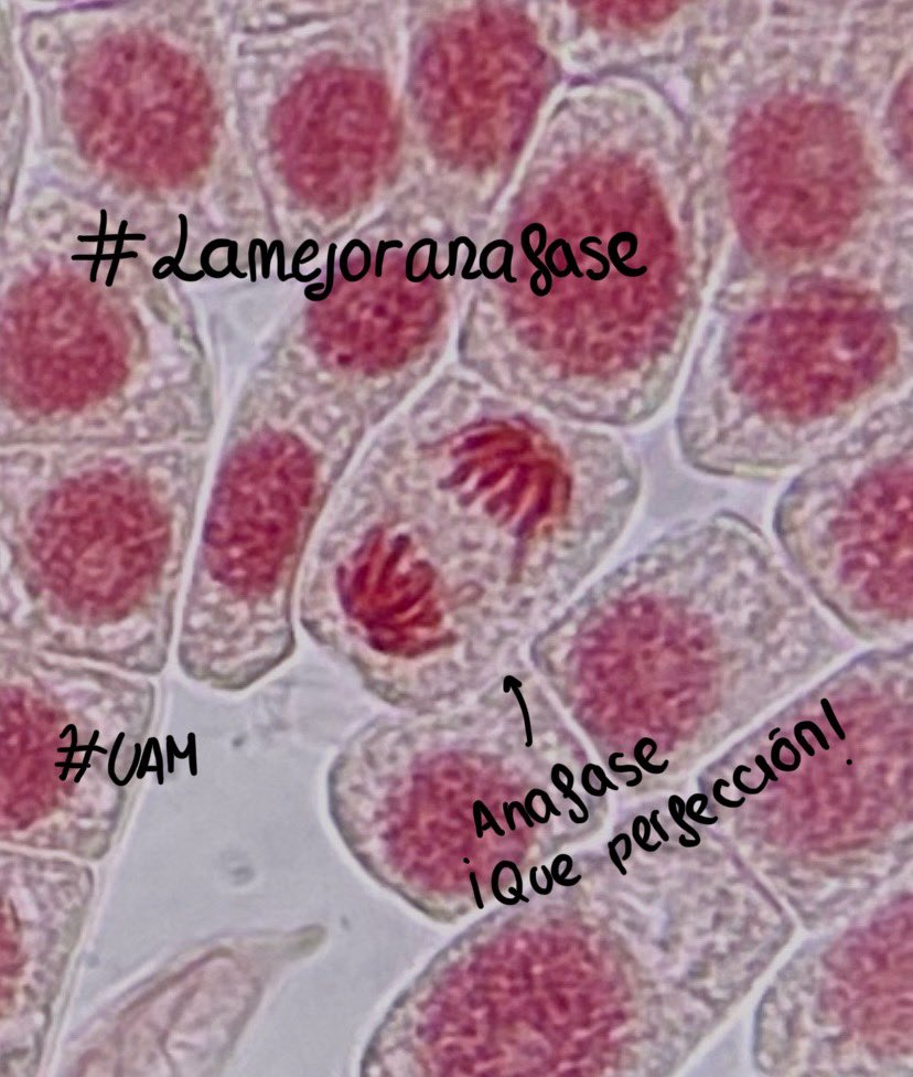 CarolG5020's tweet photo. @VegaGEscudero #practicamitosis  #BCGBMedicinaUAM24_25 #lamejoranafase 
Foto de Carolina Guerrero, esta imagen representa la anafase,donde se ve como las cromatidas hermanas son separadas y atraídas hacia los polos de la célula alejándose de la placa ecuatorial. https://t.co/5AH9XJmrUV