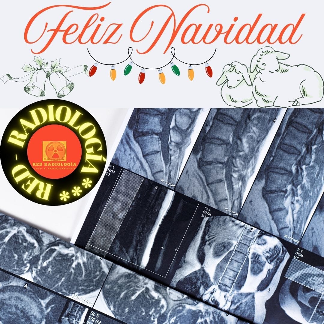 Jorge Arellano (@jorgearellanoap) on Twitter photo Feliz Navidad 🎄 y próspero año 2025 para toda la familia profesional radiológica 🩻
#Radiología #Radiodiagnóstico #TSID
#Radiographer #TSIDMN #TER #TSRT #MedicinaNuclear #Radioterapia #SeGrado #TSS
<a href="/SegraRadiologia/">SEGRA - Radiologia</a> <a href="/ACTEDI/">ACTEDI</a> <a href="/SERAM_RX/">SERAM - Sociedad Española de Radiología Médica</a> <a href="/SEGECA2021/">SEGECA</a> <a href="/SietessTecnicos/">SIETeSS- Técnicos Superiores Sanitarios</a> <a href="/setss_tss/">SETSS- Sociedad Española de Técn. Sup. Sanitarios</a> Feliz Navidad 🎄 y próspero año 2025 para toda la familia profesional radiológica 🩻
#Radiología #Radiodiagnóstico #TSID
#Radiographer #TSIDMN #TER #TSRT #MedicinaNuclear #Radioterapia #SeGrado #TSS
<a href="/SegraRadiologia/">SEGRA - Radiologia</a> <a href="/ACTEDI/">ACTEDI</a> <a href="/SERAM_RX/">SERAM - Sociedad Española de Radiología Médica</a> <a href="/SEGECA2021/">SEGECA</a> <a href="/SietessTecnicos/">SIETeSS- Técnicos Superiores Sanitarios</a> <a href="/setss_tss/">SETSS- Sociedad Española de Técn. Sup. Sanitarios</a>