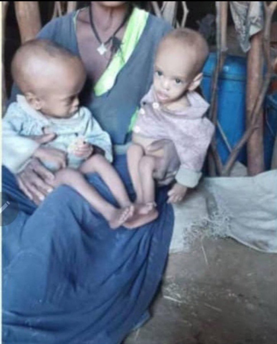 Social_Bfly07's tweet photo. Amharas are currently facing a severe food,nutrition,& health crisis, with thousands in the Wollo region experiencing acute food insecurity & starvation due to govt negligence. Immediate action is needed to address this humanitarian emergency.
#WarOnAmhara
@USAID @hrw @UN @UNICEF https://t.co/50yoHv0h9J