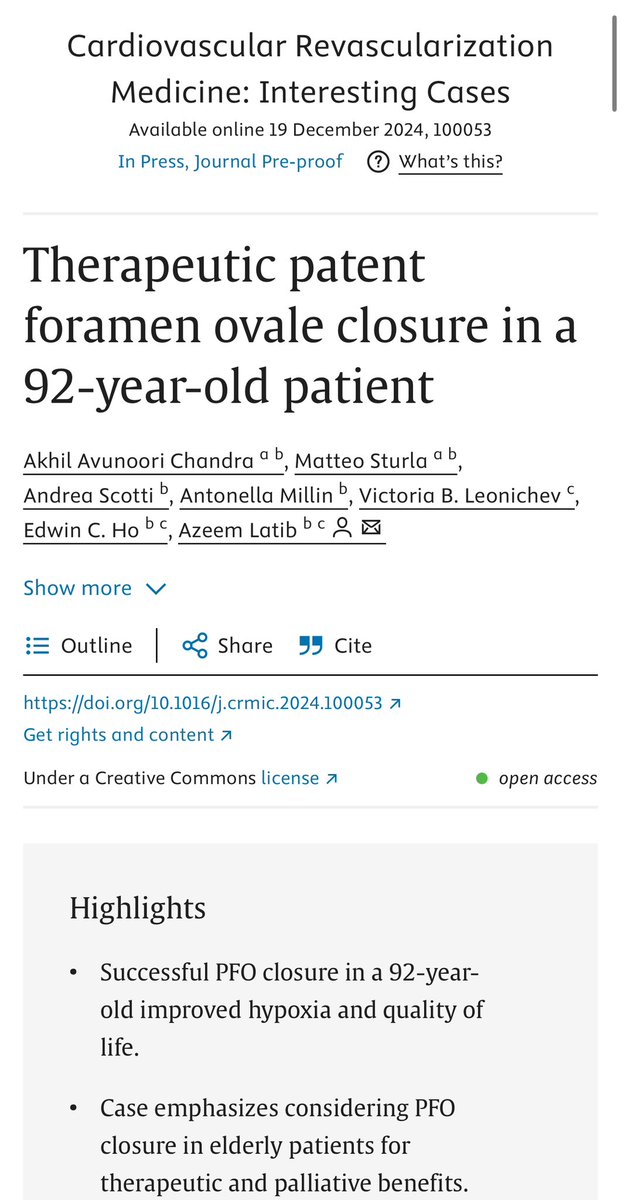 Akhil Avunoori Chandra (@akhilchandramd) on Twitter photo How does platypnea-orthodeoxia syndrome present? Read <a href="/MonteHeart/">Montefiore Heart</a> teamโs newly published case report on therapeutic PFO-closure in a 92-year-old patient to find out!
<a href="/AndreaScotti21/">Andrea Scotti</a> <a href="/MatteoSturlaM/">Matteo Sturla</a> <a href="/Antonellamillin/">Antonella</a> <a href="/EdwinHoMD/">Edwin Ho</a> <a href="/azeemlatib/">Azeem Latib</a> <a href="/montefioreIM/">Moses-Weiler Internal Medicine Residency</a>
sciencedirect.com/science/articlโฆ How does platypnea-orthodeoxia syndrome present? Read <a href="/MonteHeart/">Montefiore Heart</a> teamโs newly published case report on therapeutic PFO-closure in a 92-year-old patient to find out!
<a href="/AndreaScotti21/">Andrea Scotti</a> <a href="/MatteoSturlaM/">Matteo Sturla</a> <a href="/Antonellamillin/">Antonella</a> <a href="/EdwinHoMD/">Edwin Ho</a> <a href="/azeemlatib/">Azeem Latib</a> <a href="/montefioreIM/">Moses-Weiler Internal Medicine Residency</a>
sciencedirect.com/science/articlโฆ
