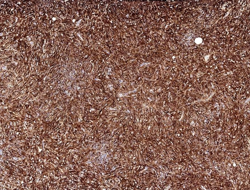 PathologyOutlines.com tweet media