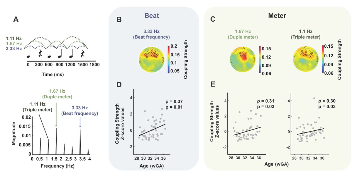 SfN Journals (@sfnjournals) on Twitter photo New in #JNeurosci: <a href="/BSaadatmehr/">Bahar Saadatmehr</a>, <a href="/SaharMoghimi1/">Sahar Moghimi</a>, et al. reveal the early developmental timeline for the neural coding of sound and auditory rhythm in humans. <a href="/UPJV_Univ/">Université de Picardie Jules Verne</a>
jneurosci.org/lookup/DOI/10.… New in #JNeurosci: <a href="/BSaadatmehr/">Bahar Saadatmehr</a>, <a href="/SaharMoghimi1/">Sahar Moghimi</a>, et al. reveal the early developmental timeline for the neural coding of sound and auditory rhythm in humans. <a href="/UPJV_Univ/">Université de Picardie Jules Verne</a>
jneurosci.org/lookup/DOI/10.…